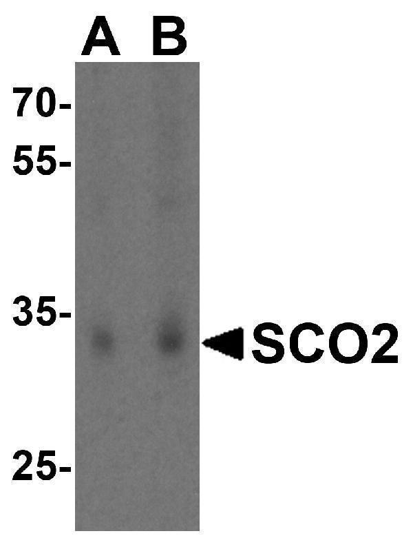 Western blot analysis of SCO2 in HL60 cell lysate lysate with SCO2 antibody at (A) 1 and (B) 2 μg/mL