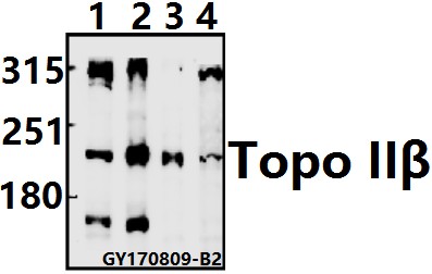 Western blot (WB) analysis of Topo IIβ (A32) pAb at 1:500 dilution
Lane1:A549 whole cell lysate(20ug)
Lane2:HEK293T whole cell lysate(20ug)
Lane3:AML-12 whole cell lysate(20ug)
Lane4:PC12 whole cell lysate(40ug)