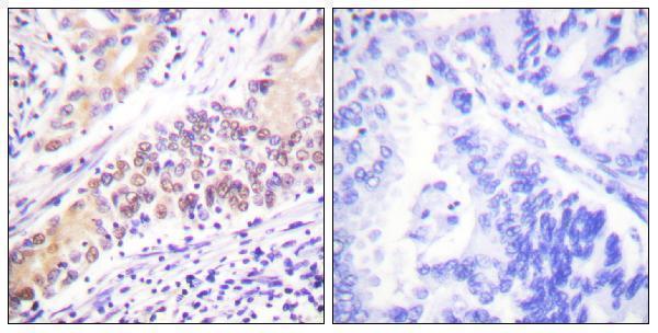 a02750 top2b primary antibodies ihc testing 1