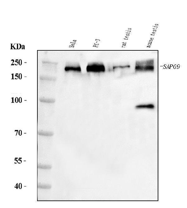  Western blot analysis of JLP/SPAG9 using anti-JLP/SPAG9 antibody (A02751-1)
