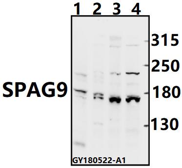 Western blot (WB) analysis of SPAG9 pAb at 1:500 dilution
Lane1:AML-12 whole cell lysate(40ug)
Lane2:U-87MG whole cell lysate(40ug)
Lane3:EC9706 whole cell lysate(40ug)
Lane4:SGC7901 whole cell lysate(40ug)