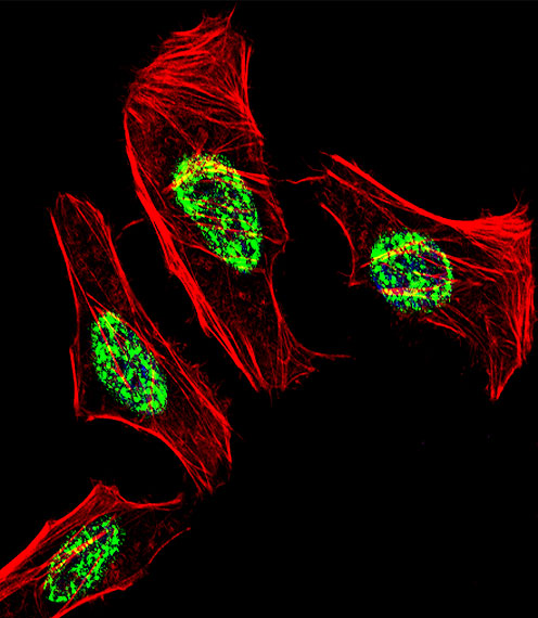 Fluorescent confocal image of Hela cell stained with NR2C2 Antibody (C-term)
