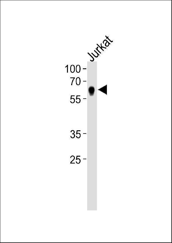 NR2C2 Antibody (C-term) western blot analysis in Jurkat cell line lysates (35ug/lane)