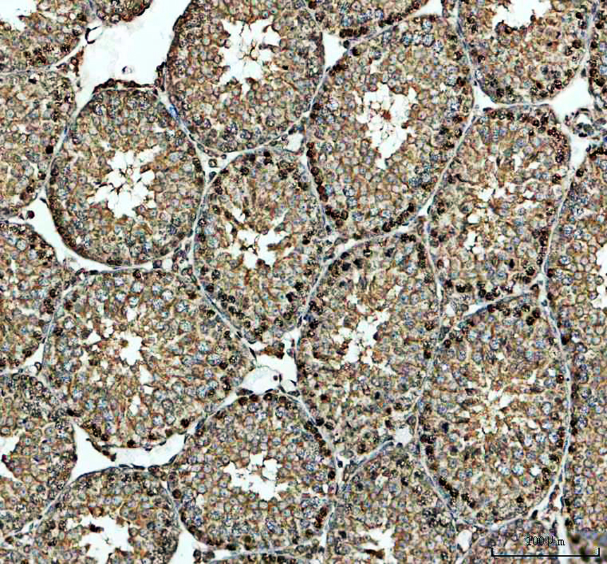 IHC analysis of NR2C2 using anti-NR2C2 antibody (A02752-2)