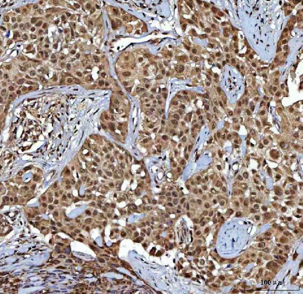  IHC analysis of NR2C2 using anti-NR2C2 antibody (A02752-2)