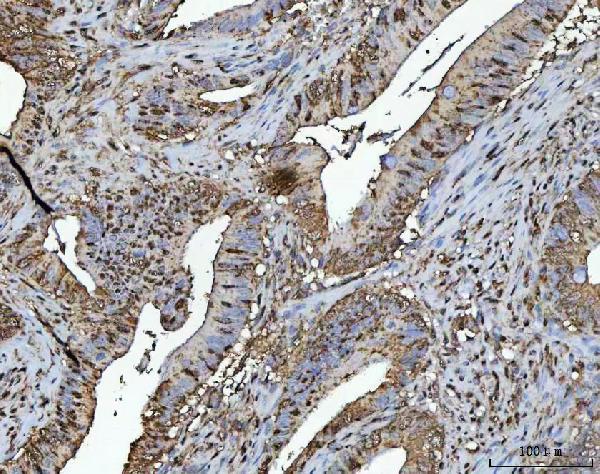  IHC analysis of NR2C2 using anti-NR2C2 antibody (A02752-2)