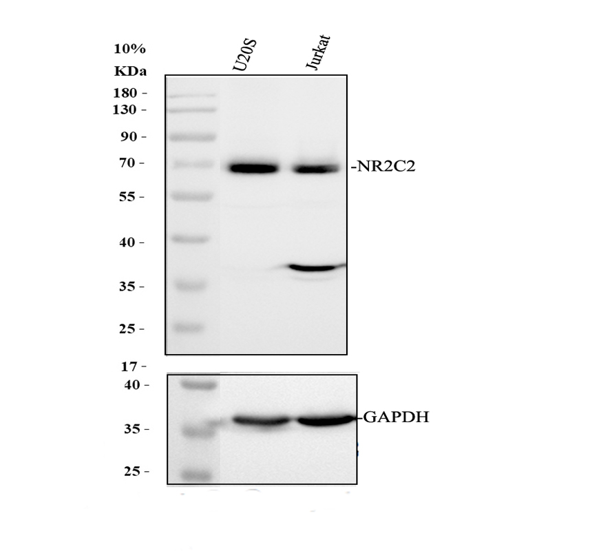 Western blot analysis of NR2C2 using anti-NR2C2 antibody (A02752-2)