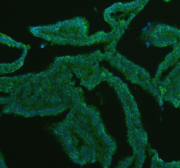 a02754 1 gatm primary antibodies if testing 1