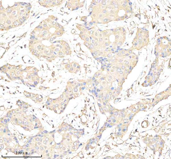  IHC analysis of GATM using anti-GATM antibody (A02754-1)