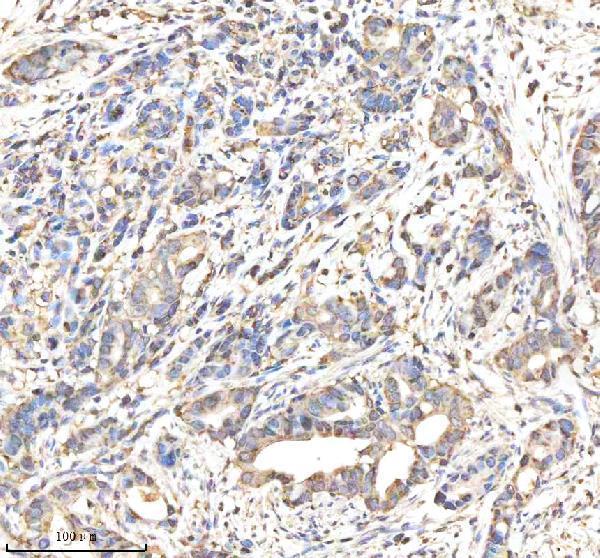  IHC analysis of GATM using anti-GATM antibody (A02754-1)
