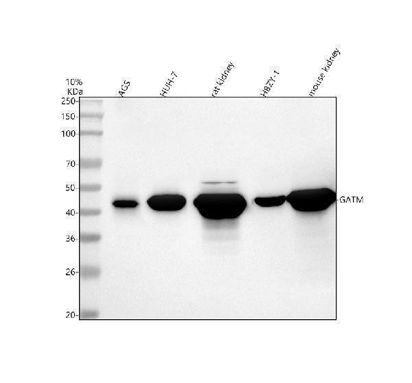  Western blot analysis of GATM using anti-GATM antibody (A02754-1)