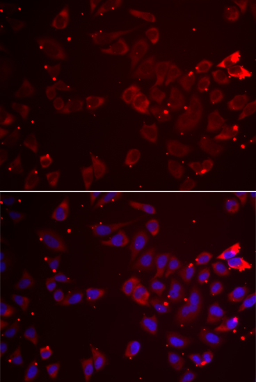 a02754 gatm primary antiboties if testing 3