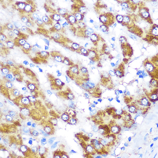 a02754 gatm primary antiboties ihc testing 2
