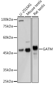 a02754 gatm primary antiboties wb testing 1