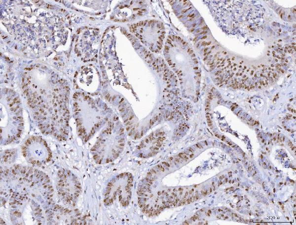a02755 1 mcm6 primary antibodies ihc testing 2_1