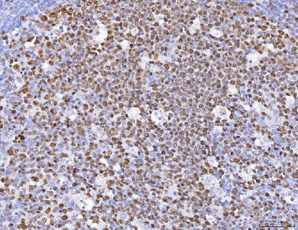 a02755 1 mcm6 primary antibodies ihc testing 3_1