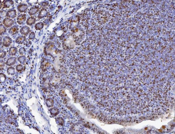 a02755 1 mcm6 primary antibodies ihc testing 4_1