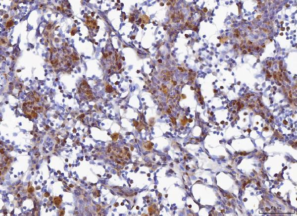 a02755 1 mcm6 primary antibodies ihc testing 5