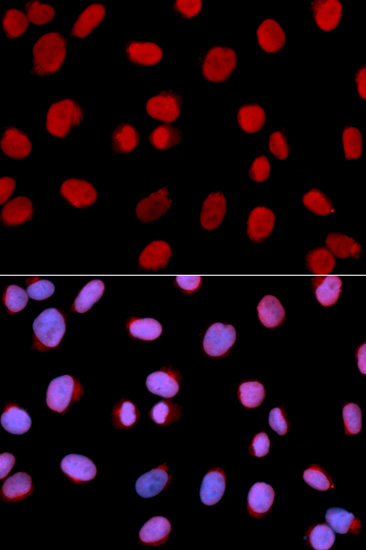 Immunofluorescence analysis of U2OS cells, using MCM6 polyclonal antibody