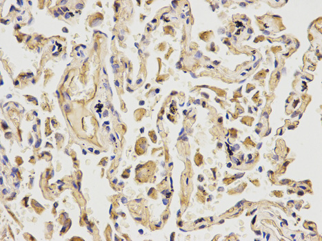 Immunohistochemistry (IHC) analysis of MCM6 polyclonal antibody in paraffin-embedded Human Lung tissue