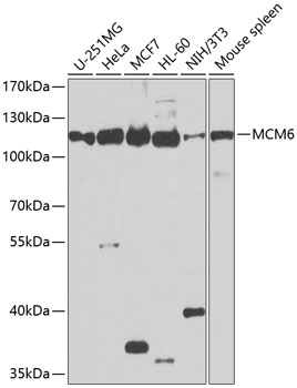 Western blot analysis of MCM6 polyclonal antibody