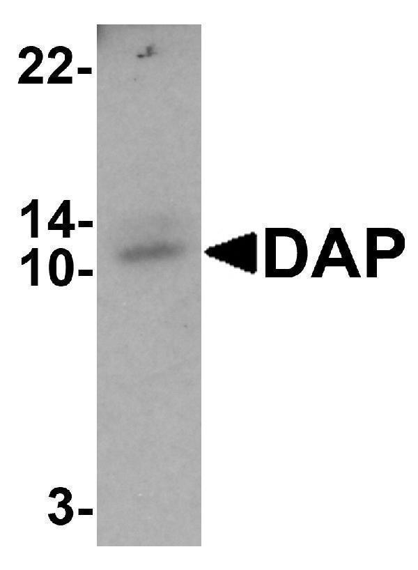 Western blot analysis of DAP in human small intestine tissue lysate with DAP antibody at 1 μg/mL