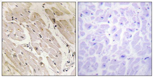 Immunohistochemistry analysis of paraffin-embedded human heart tissue, using PRKAG2 Antibody