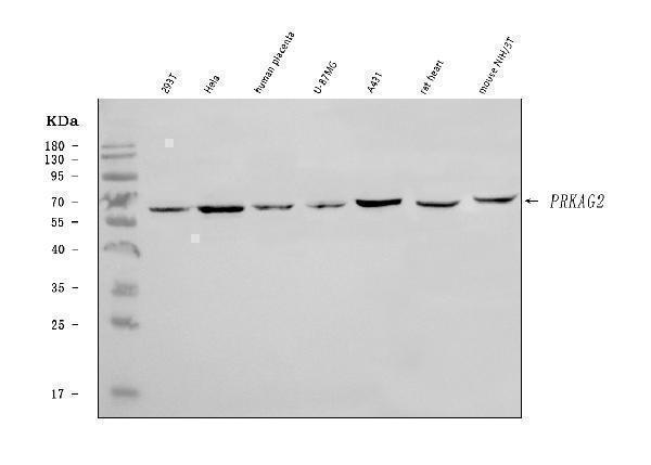  Western blot analysis of PRKAG2 using anti-PRKAG2 antibody (A02758-3)