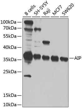 a02759 aip primary antiboties wb testing 1