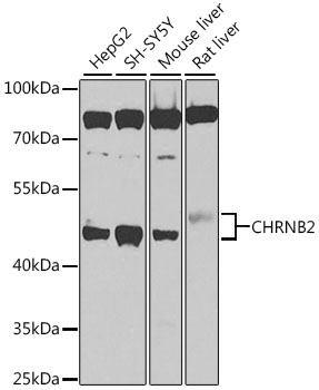 a02761 chrnb2 primary antiboties wb testing 1