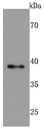 Western blot analysis of TIA1 on Jurkat cells lysates using anti-TIA1 antibody at 1/500 dilution