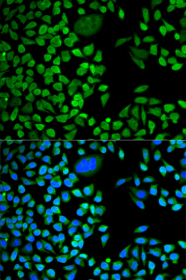 Immunohistochemistry of paraffin-embedded human tonsil using TIA1 antibody  at dilution of 1:100 