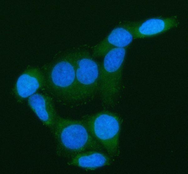 a02764 2 arhgef7 primary antibodies if testing 12