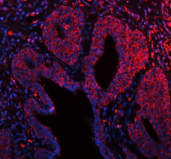 a02764 2 arhgef7 primary antibodies if testing 15