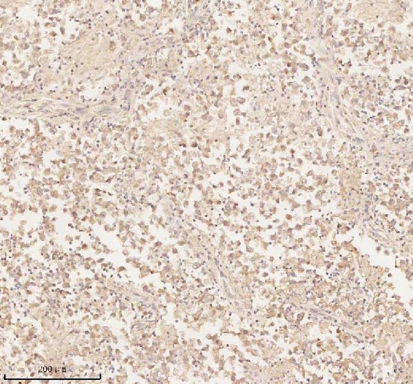 a02764 2 arhgef7 primary antibodies ihc testing 10
