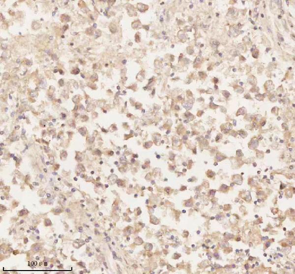 a02764 2 arhgef7 primary antibodies ihc testing 11