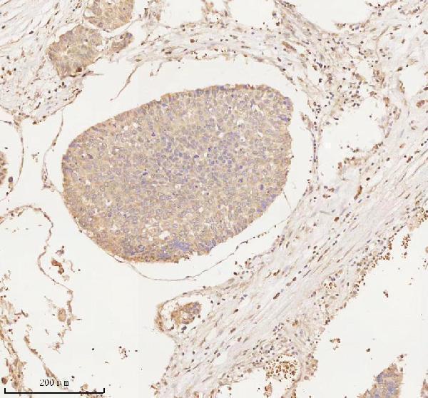  IHC analysis of ARHGEF7 using anti-ARHGEF7 antibody (A02764-2)
