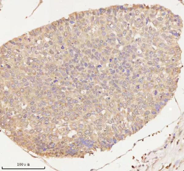  IHC analysis of ARHGEF7 using anti-ARHGEF7 antibody (A02764-2)