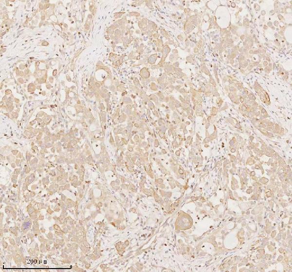 a02764 2 arhgef7 primary antibodies ihc testing 4