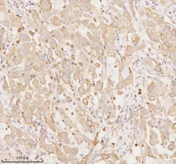 a02764 2 arhgef7 primary antibodies ihc testing 5