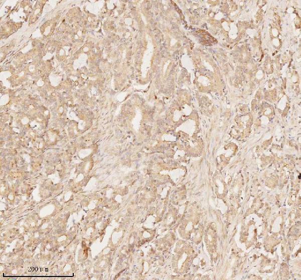 a02764 2 arhgef7 primary antibodies ihc testing 6