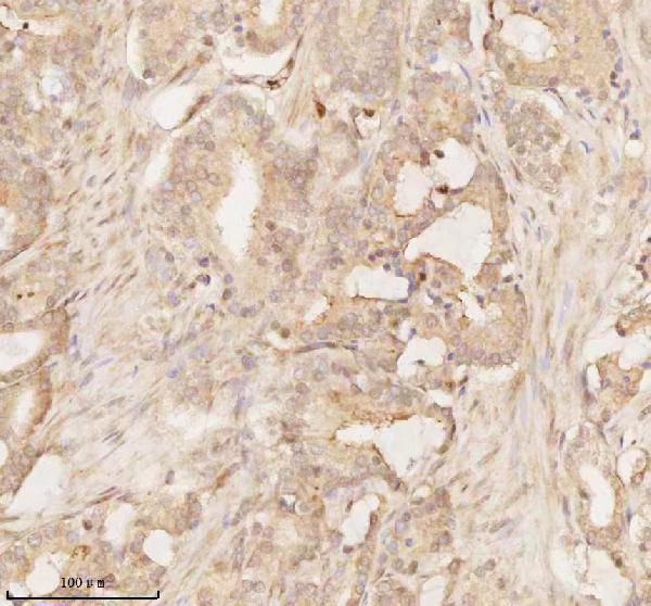 a02764 2 arhgef7 primary antibodies ihc testing 7