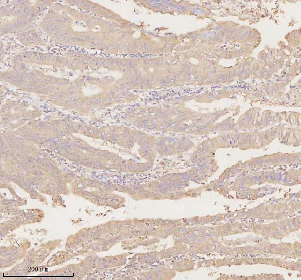 a02764 2 arhgef7 primary antibodies ihc testing 8