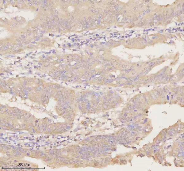 a02764 2 arhgef7 primary antibodies ihc testing 9