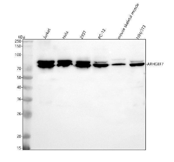  Western blot analysis of ARHGEF7 using anti-ARHGEF7 antibody (A02764-2)
