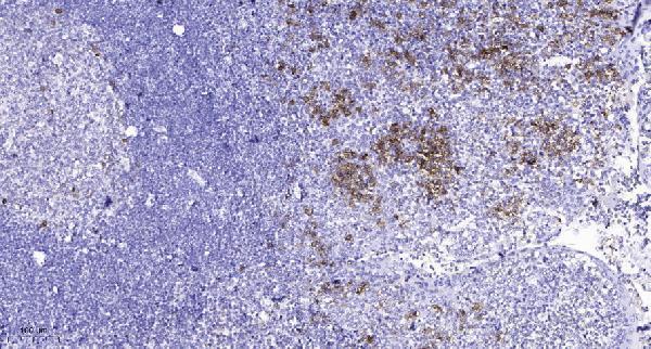 a02764 arhgef7 primary antibodies ihc testing 1