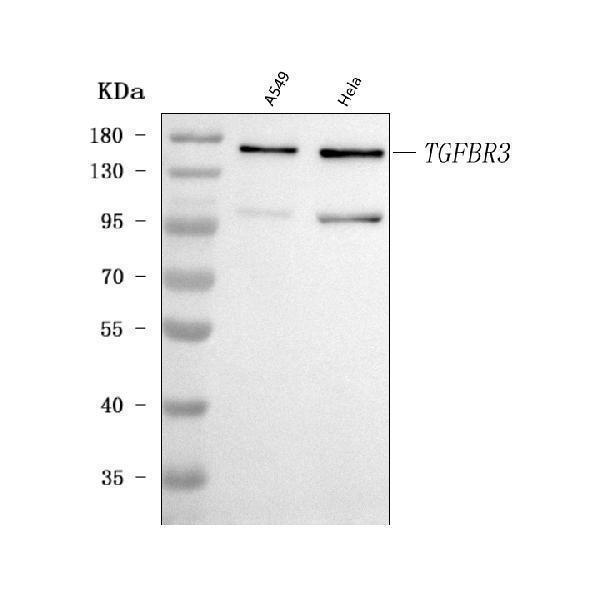  Western blot analysis of TGF Beta Receptor III/TGFBR3 using anti-TGF Beta Receptor III/TGFBR3 antibody (A02765-5)
