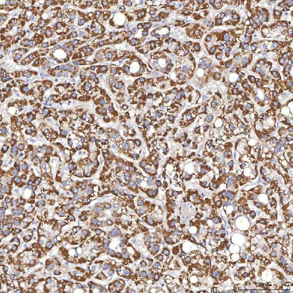  IHC analysis of Thyroxine Binding Globulin/SERPINA7 using anti-Thyroxine Binding Globulin/SERPINA7 antibody (A02766-1)