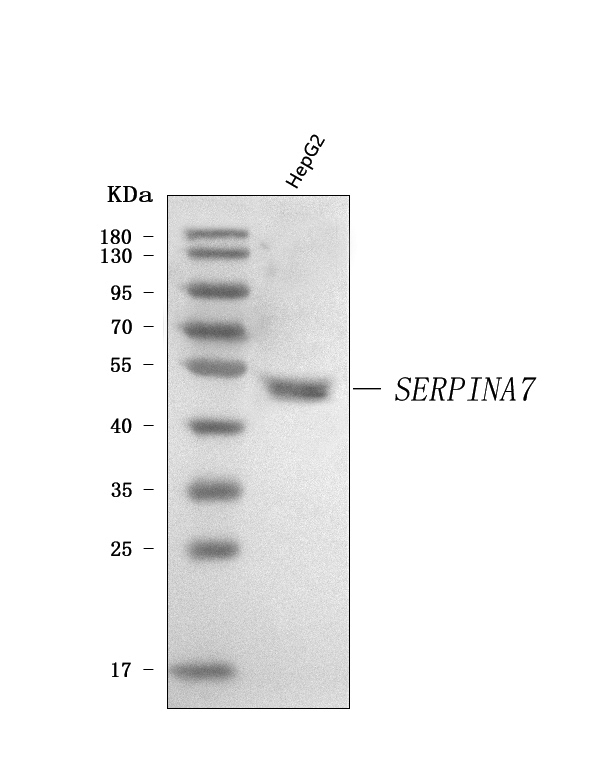  Western blot analysis of Thyroxine Binding Globulin/SERPINA7 using anti-Thyroxine Binding Globulin/SERPINA7 antibody (A02766-1)