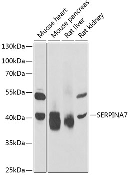 Western blot analysis of extracts of various cell lines, using SERPINA7 antibody  at 1:1000 dilution